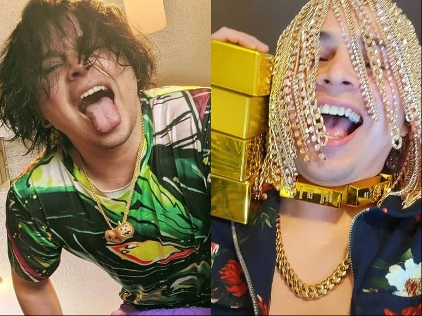 Rapero se quita el pelo y se implanta en el cráneo cadenas de oro de 70 millones de pesos